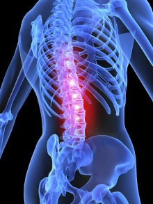 Low back pain and sciatica