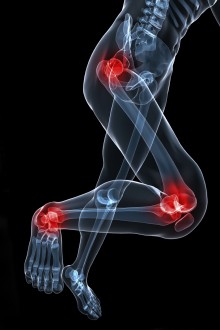Sporting injuries to hip, knees and ankle
